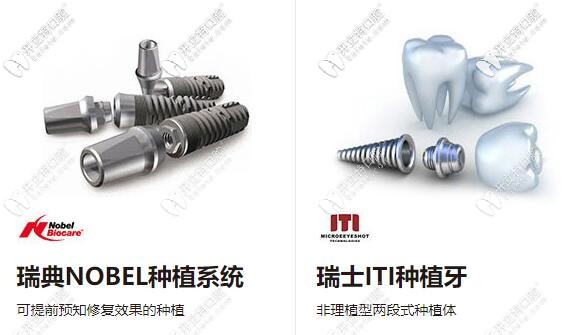中山好民生口腔合作的高端種植牙品牌：瑞典諾貝爾、瑞士ITI種植體