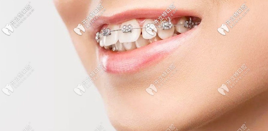 劇透南陽(yáng)口腔醫(yī)院收費(fèi)價(jià)格表，正畸和種牙費(fèi)用還不貴呢