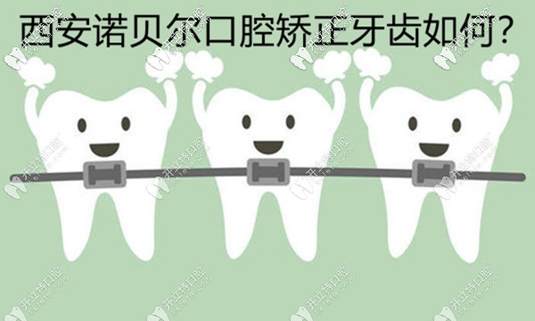 西安諾貝爾口腔矯正牙齒好不好，用正畸病例來(lái)評(píng)價(jià)下