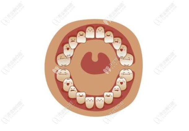 兒童早起干預(yù)矯正的重要性 兒童早起干預(yù)矯正的重要性