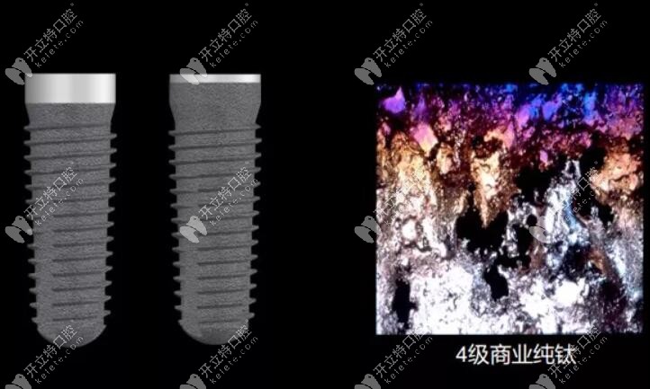 德國進口種植體品牌camlog好不好？看其材質性價比蠻高的