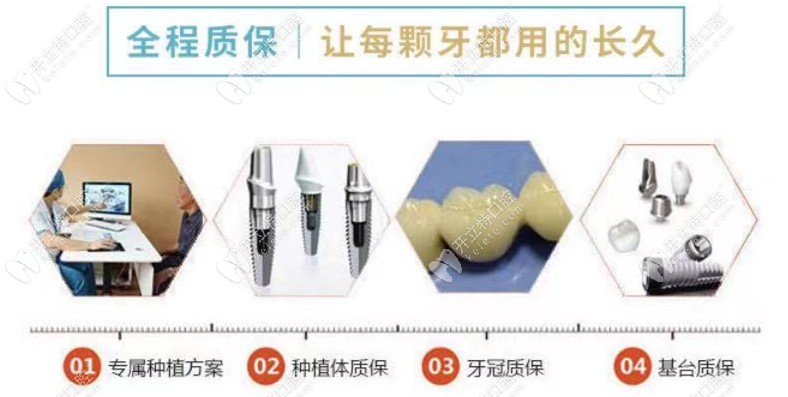 每顆牙用30年左右 每顆牙用30年左右