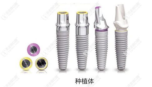 分享沈陽盛大口腔價格表，盛大做種植牙口碑好價格還不貴