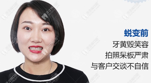 牙黃毀笑容，拍照呆板