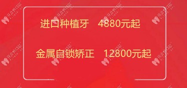 曙光口腔發(fā)來(lái)韓國(guó)登騰種植牙4880元起優(yōu)惠價(jià)格，終于等到了