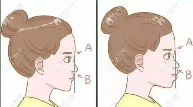 這項技術(shù)針對國內(nèi)凸面畸形